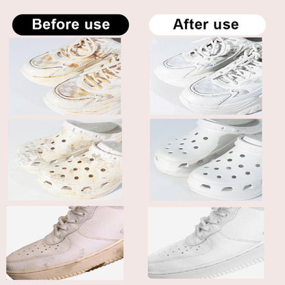 All-Purpose Stain Removal Wipes